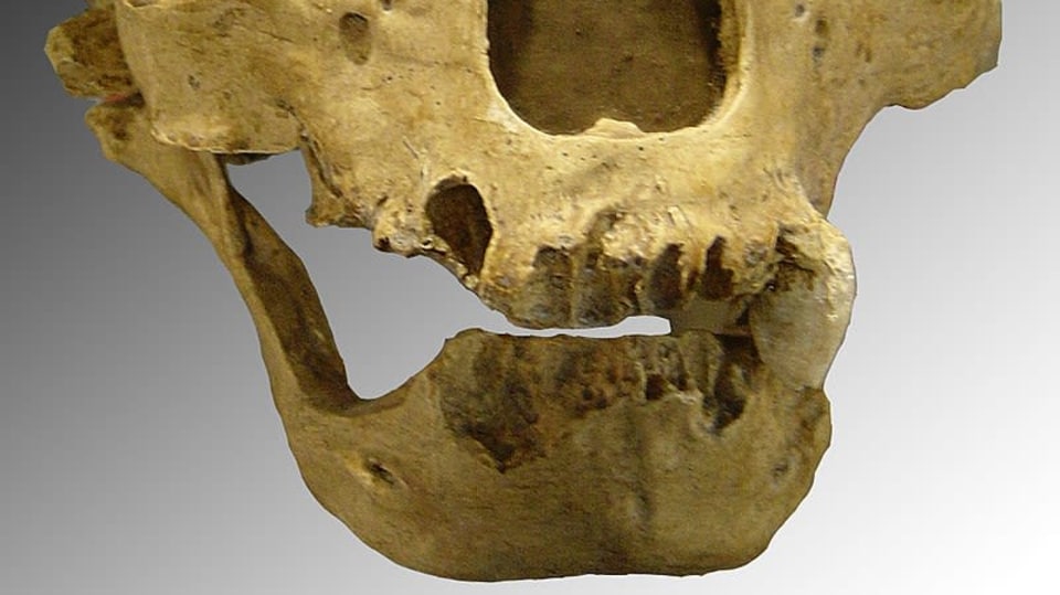 Lebka neandertálce má výrazné nadočnicové oblouky a nízké čelo